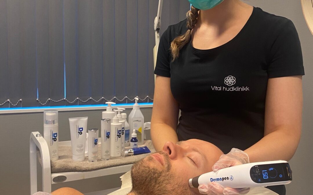 Dermapen